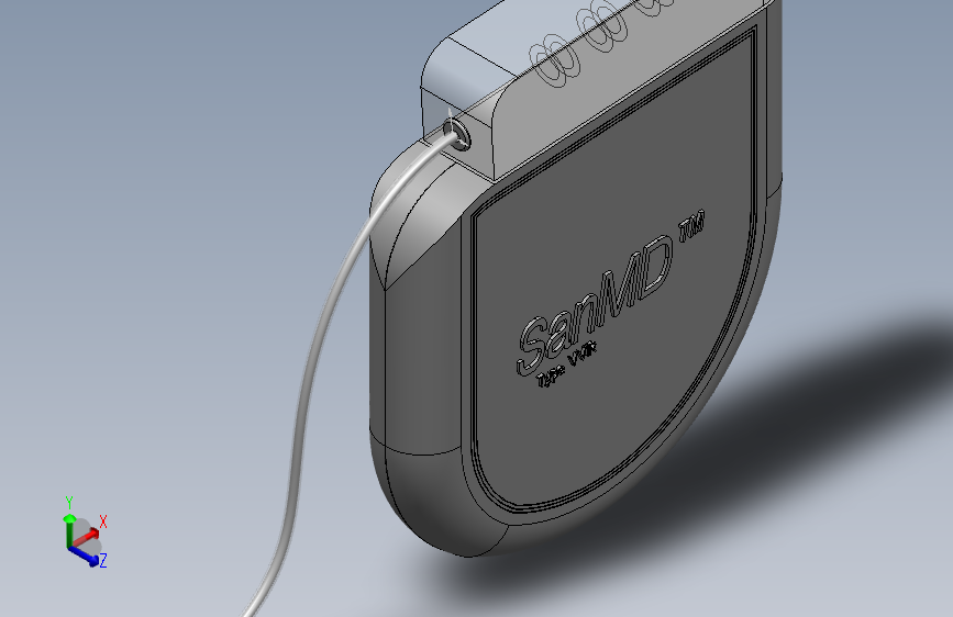 3D植入式心脏逆转除颤器（ICD）的3D模型