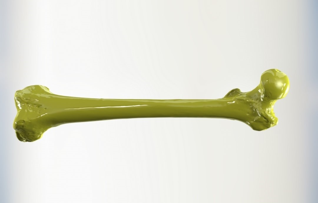 股骨远端是腿部膝关节正上方的区域