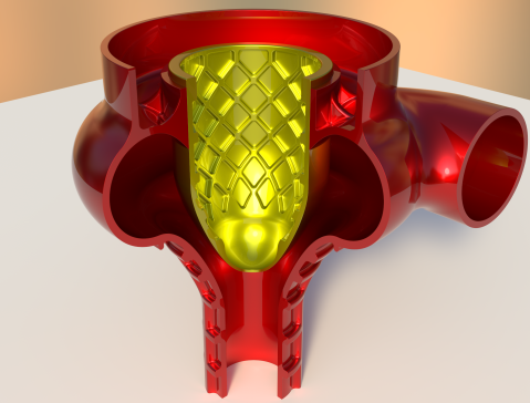 抛物线障碍物节流阀，变体A