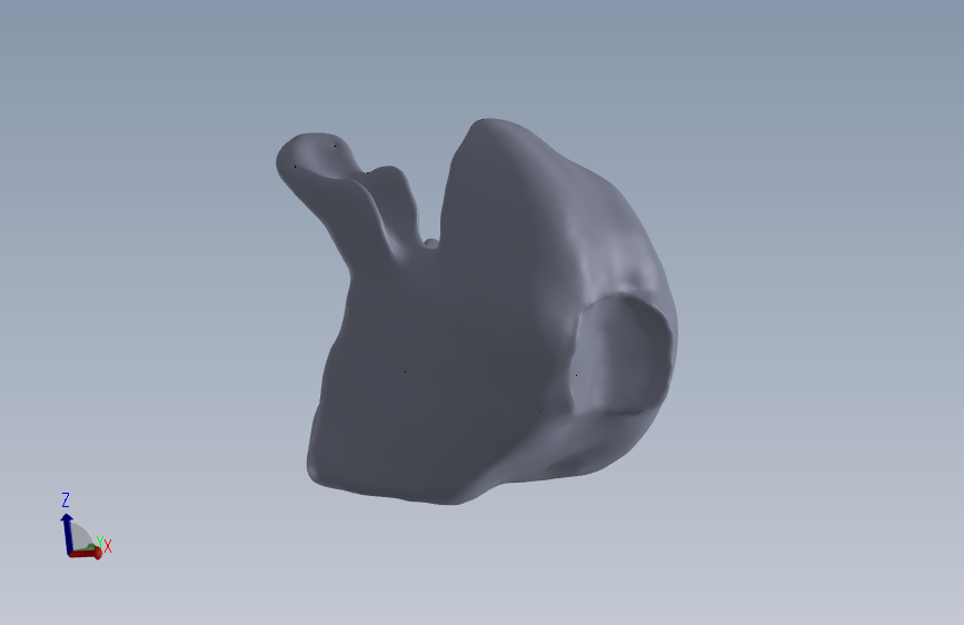 SolidWorks的膝骨设计。