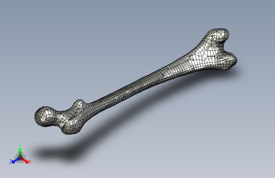 钛骨假体的分析与Ansys (FEA)