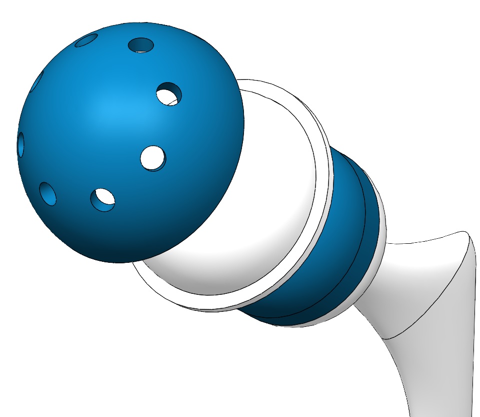 012-假肢-髋关节假体 SW