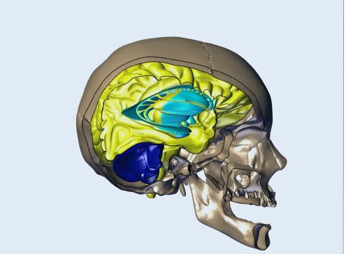 人类大脑和头骨模型3D图纸 CATIA设计 附IGS