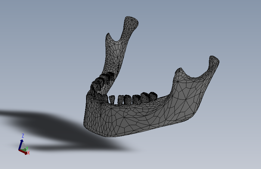 人的下颌骨 3D模型SolidWorks三维设计图